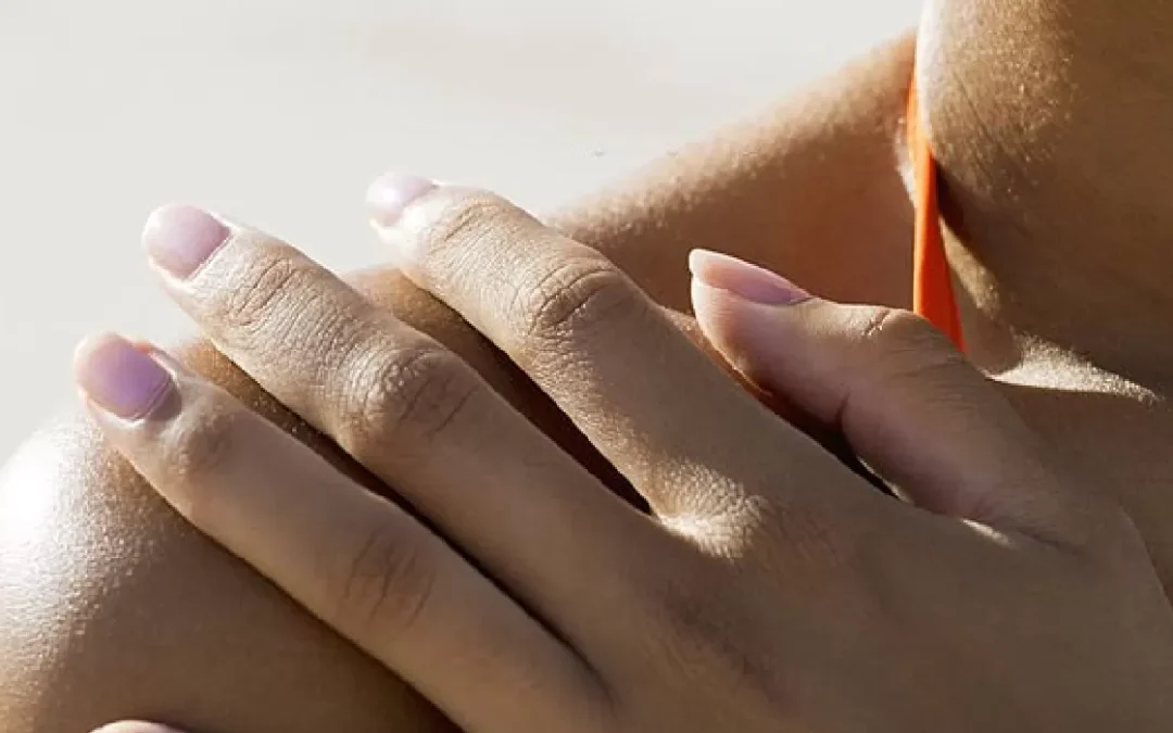 5 summer skincare tips